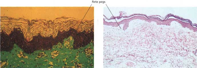 This shows all three skin layers: epidermis, dermis, subcutaneous fat